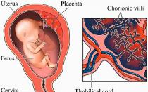 Жүктілік кезіндегі ауыр асқынулар: плацентаның бөлінуі